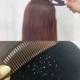 Self-cleaning Dandruff Comb Scalp Care Massage Comb for Scalp Exfoliation for Women and Men