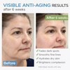 Collagen Retinol Face Cream – Anti-aging moisturizer with hyaluronic acid