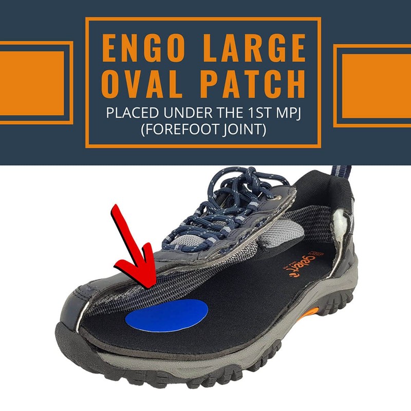 ENGO Blister Prevention Patches x 2 Large Ovals