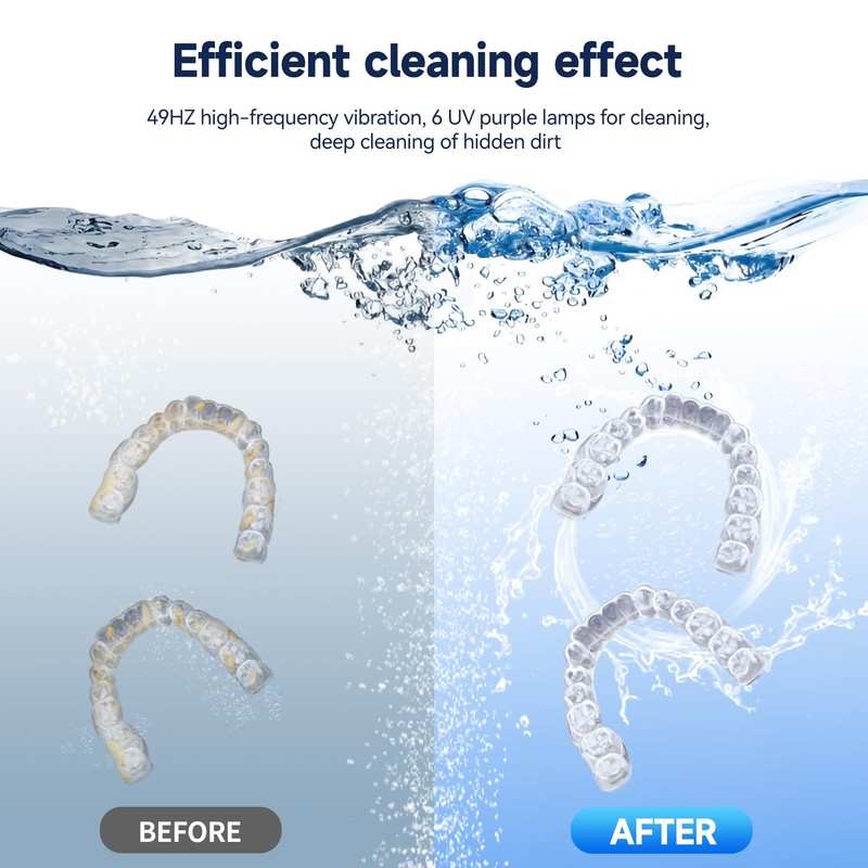 Doeean Ultrasonic Retainer Cleaner Machine Retainer Cleaner For Dentures 6