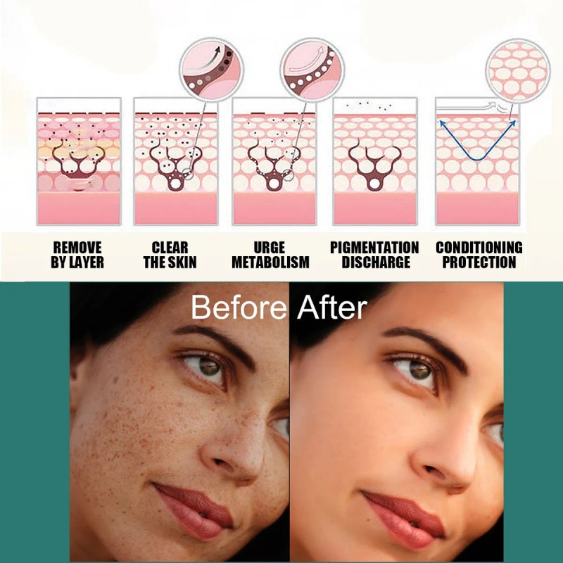 Crema Iluminadora Facial Paño Eelhoe Manchas Melasma Manchas