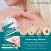 Crema Herbal Ayuda A Eliminar Mezquinos En La Piel