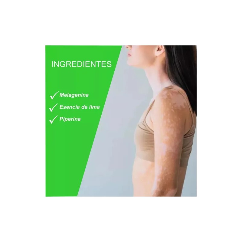 Tratamiento Integral Para Vitiligo En Todo El Cuerpo