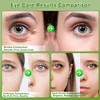 Lktvys Aloe Vera Eye Gel Patches 2 Pack 120 PCS,