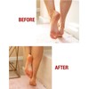 Kerasal Intensive Foot Repair Skin Healing Ointment, 1 Oz and
