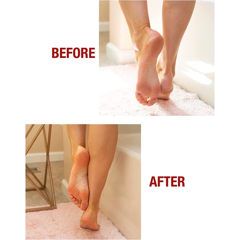 Kerasal Intensive Foot Repair Skin Healing Ointment, 1 Oz and