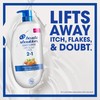 Head and Shoulders Dry Scalp Care with Almond Oil 2-in-1