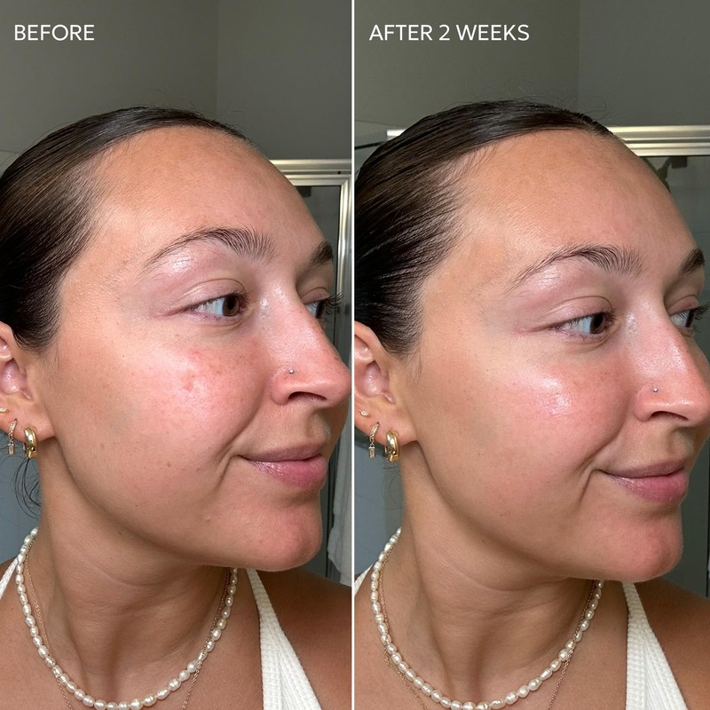 Dermisa Skin Fade Cream with Vitamin C | Helps Reduce