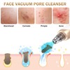 Blackhead Remover Pore Vacuum Kit - 2023 Upgraded Blackhead Extractor