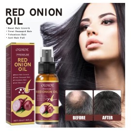 Aceite De Cebolla For El Crecimiento Del Cabello Xd.