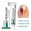 Ungüentopara Hongo De Uñas Elimina Eficazmente Los Hongo