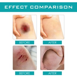 Liquid Wound Dressing, Skin Glue for Wounds Human, Liquid Plaster,Waterproof & Breathable, Compact Dropper Design, Wound Wash, New Skin Liq/uid Plaster, Suitable for Everyone,Ingredient Safety