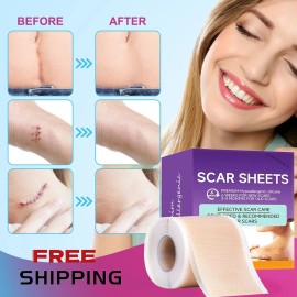 Unbranded Silicone Scar Sheets,(1.6" X 60" Roll-1.5M) Silicone Scar Tape for Surgical Scar