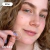 Cosrx - Parche Maestro Para Acné Espinillas | A.d.f. Apósito