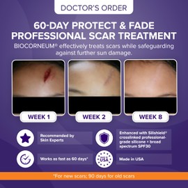 Biocorneum Advanced Scar Treatment – Silicone Scar Gel with Silishield® & SPF 30 20g – Scar Cream for Surgical Scars, C-Section & Acne – Fast Drying, Water Resistant Scar Removal Gel - for Children