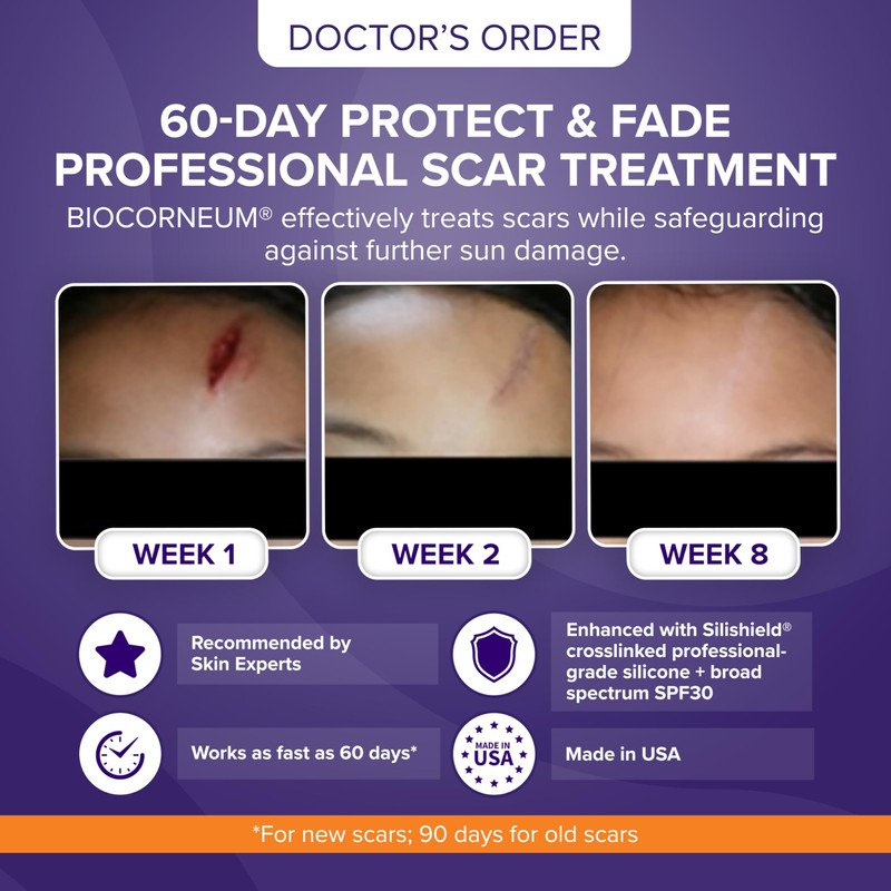 Biocorneum Advanced Scar Treatment – Silicone Scar Gel with Silishield®