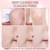 Cleansing Exfoliating Gel, Gentle Face & Body Peeling (1 Pcs)
