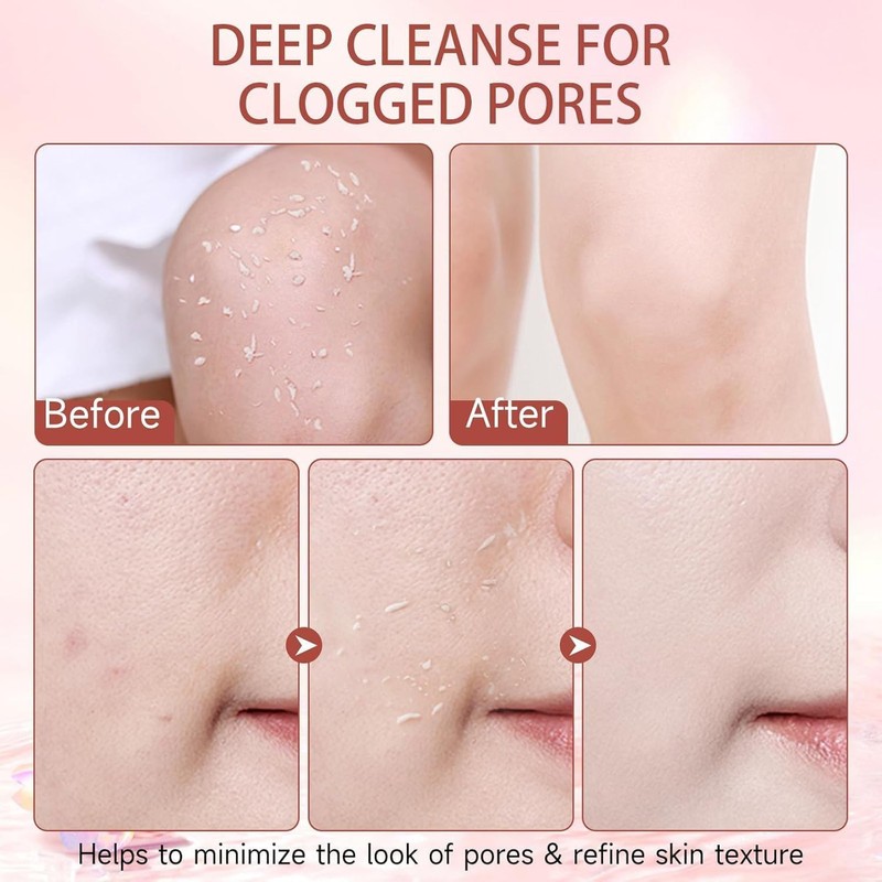 Cleansing Exfoliating Gel, Gentle Face & Body Peeling (1 Pcs)