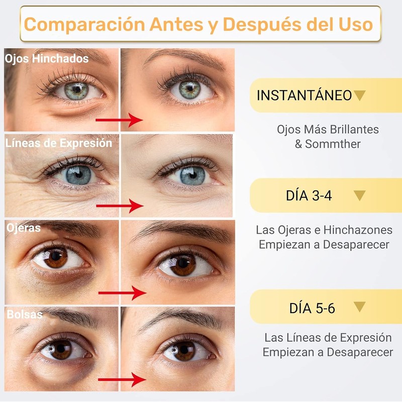 Parches para Ojos Ojeras 24k Oro-30 Pares- Parches de Colageno