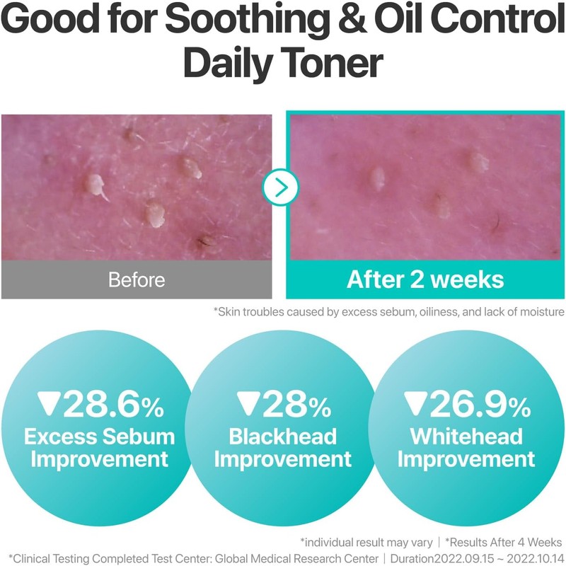 No.1 Pure-Full Calming Herb Toner