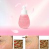 URANG Pink Everlasting Ampoule 35ml