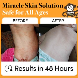 Monkey Balm All Natural Skin Care for Kids, Babies, Adults for Dry, Cracked Skin, Skin Irritation, Rashes, healing balm 0.6 oz