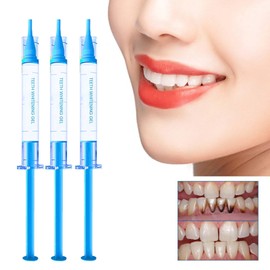 Zahnfleischwachstumsgel, Gum Shield Therapy Gel, Essenz Zahnfleischtherapie, Essenz zur Zahnfleischreparatur, Gummi-Therapie-Gel, zur Reparatur von Zahnfleischschwellungen, Gel zur Behandlung von