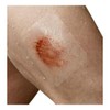Nexcare Tegaderm Transparent Dressings 4 Inches X 4 4 Inches