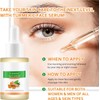 Turmeric and Vitamin C Face Serum, Turmeric Serum for Dark
