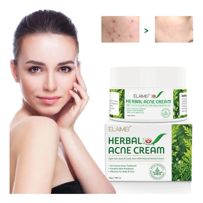 Crema Herbal Antiacné Control Grasa, Granos Espinillas 2 Pzs Acneica
