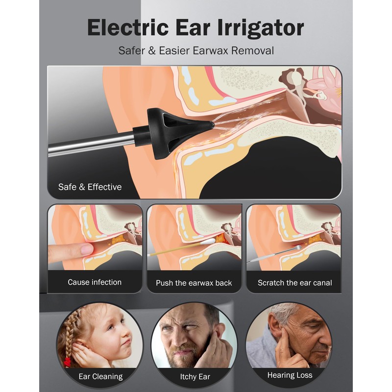 Hommie Hommie Ear Wax Removal, Ear Cleaner, Safe Ear Wax