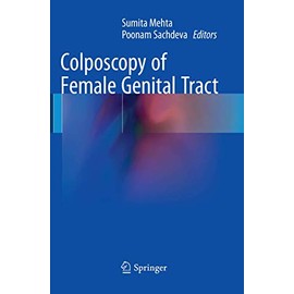 Colposcopy of Female Genital Tract