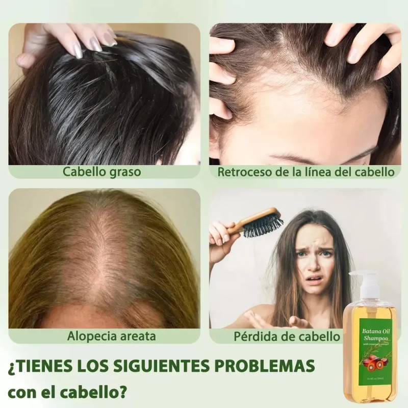 Shampoo Batana Y Crecimiento Y Reparación Capilar 300ml