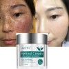 Crema Retinol Aclarante Zonas Intimas Perianal Entrepierna Neutra
