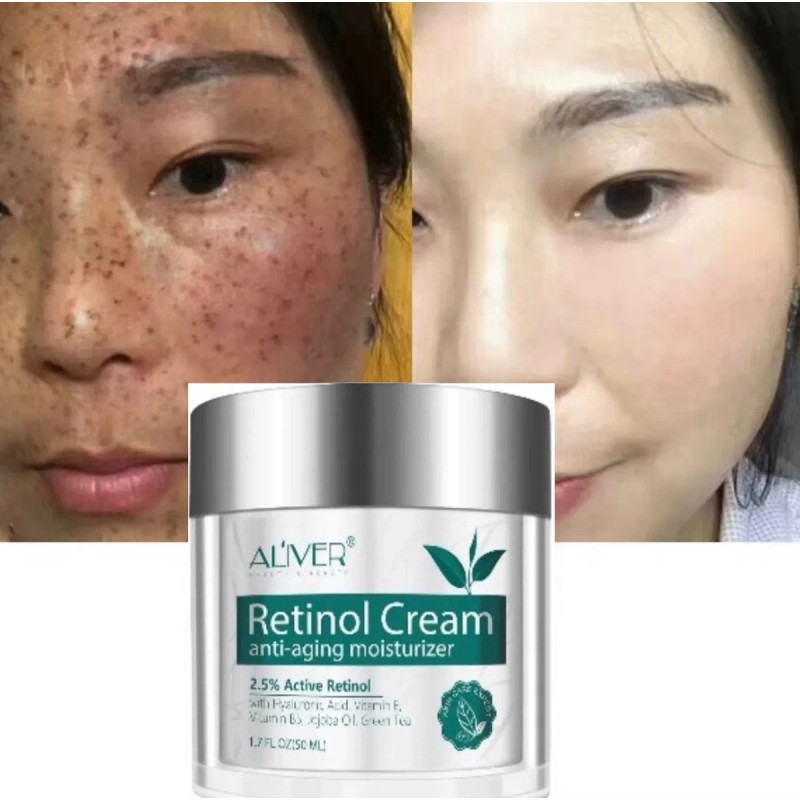 Crema Retinol Aclarante Zonas Intimas Perianal Entrepierna Neutra