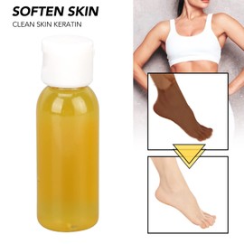 Yellow Peeling Oil, Dark Skin Peeling Oil Exfoliating Peeling Oil, Yellow Peeling Solution, Skin Whitening Exfoliator Suaviza la piel Eliminación de callos Exfoliación Fácil de