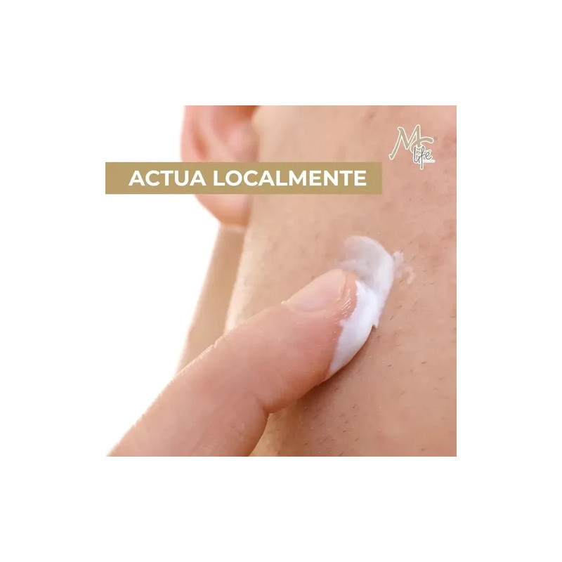 2 Cremas Anti Acné, Reduce Manchas, Control Grasa. Mc Life