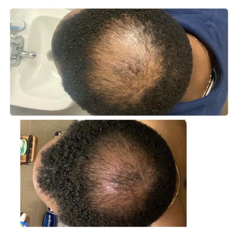 Deep Conditioner Mask for Hair Repair by Kreyòl Essence, 8