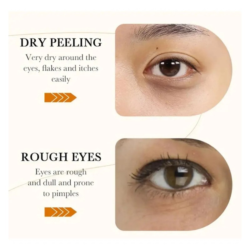 Parches Hidrogel Ojos Bioaqua De Arroz Elimina Ojeras F Todo