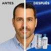 Folcress Xpert Shampoo Anticaída Libre de Sulfatos y Parabenos Grisi