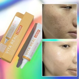 Pigmentation-specific cream for spot removal, back, crotch, back of neck, pigmentation ointment cream 15ml (2 pieces) / 착색 전용 크림 반점 제거 등 가랑이 목뒤 착색 색소 침착 연고 크림 15ml 2개