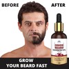  Onion Beard Growth Oil | Beard Oil for Patchy