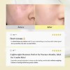 Dr. Althea Ceramidas: Hidratación Para Piel Sensible Juego3