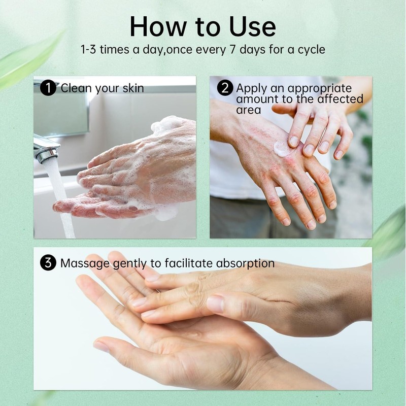 Jendfert 2 Pcs Eczema Cream