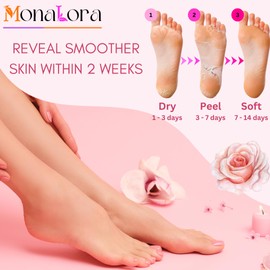 MonaLora Foot Peel Mask for Dry, Cracked Heels – Exfoliating Callus Remover with Natural Fruit Extracts – Baby Soft Feet in 1 Week – 2 Packs | Lavender Scent