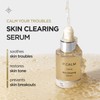 P.CALM Skin Clearing Serum 30ml