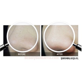 RIRE All Kill Blackhead Remover Stick 10g