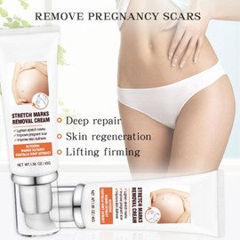 Dehnungsstreifen Creme, Anti Stretch Mark Body Cream, Creme für Dehnungsstreifen, Stretch Marks Cream Narbencreme, Anti-Aging Anti-Falten Straffende Körpercremes