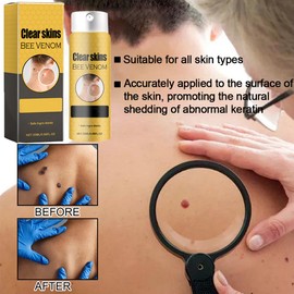 Qianghong 2PCS Bee Venom Spray, Moisturizing and Smoothing Skin Spray Suitable for All Skin Types of Women and Men