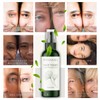 THANIKA Centella Asiatica Face Toner Spray - Anti-Aging & Acne